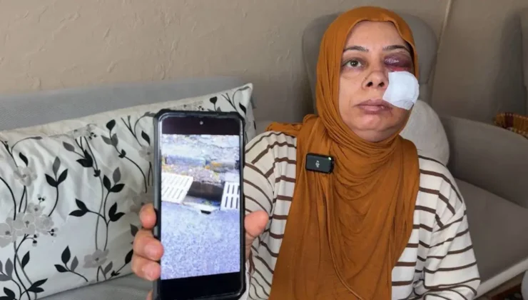 Elektrikli bisikleti ile kapağı kırık rögara düştü: Yüzüne 14 dikiş atıldı