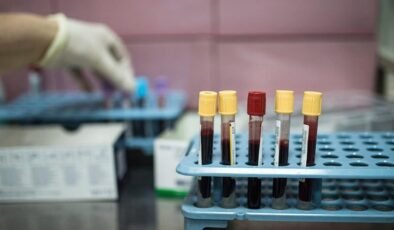 Dünyada her yıl 20 milyon, Türkiye’de ise 240 bin kişi kanser tanısı alıyor