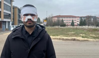 Eskişehir’de rehber öğretmeni, fizik öğretmeninin yüzüne sıcak çay fırlattı