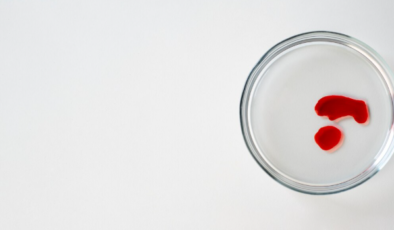 Meniden Kan Gelmesi (Hemospermi) Nedir? – Op. Dr. Taner Çavumirza