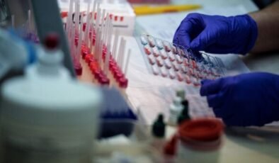 Yeni test, idrar yolu enfeksiyonunda tedaviyi aynı güne indiriyor