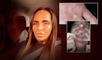 Komşusundan sessiz olmasını isteyince kabusu yaşadı! Saçlarını yolup, dişlerini kırdı