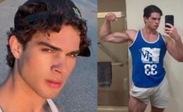 Güzellik uğruna çenesine çekiçle vurdu! Denediği yöntemlerden kısır kaldı