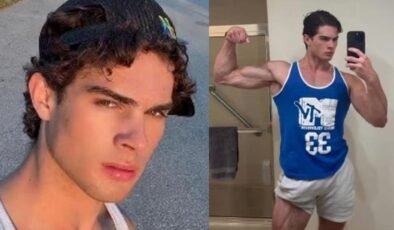 Güzellik uğruna çenesine çekiçle vurdu! Denediği yöntemlerden kısır kaldı