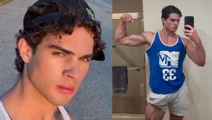 Güzellik uğruna çenesine çekiçle vurdu! Denediği yöntemlerden kısır kaldı