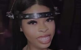 Kafasında 15 vidayla yaşıyor! Sosyal medyada paylaşıp…