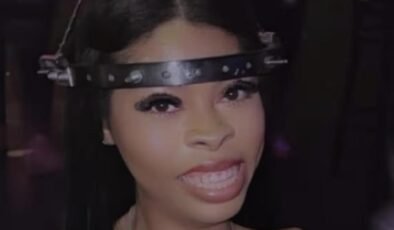 Kafasında 15 vidayla yaşıyor! Sosyal medyada paylaşıp…