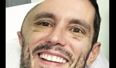 Metroda düştü, uyandığında kafatasının yarısı yoktu! "Dokunduğumda beynimi hissedebiliyordum”