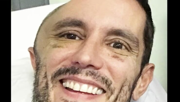 Metroda düştü, uyandığında kafatasının yarısı yoktu! "Dokunduğumda beynimi hissedebiliyordum”