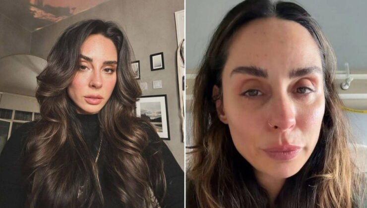 Hepsi grubunun eski üyesi Yasemin Yürük’ten korkutan haber: Ameliyat edildi, platin takıldı!