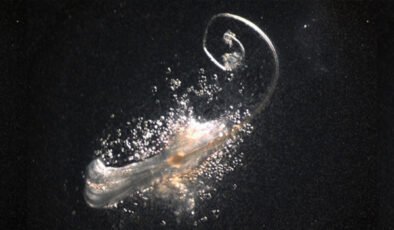 Saç dökülmesinde önemli gelişme: Laboratuvarda gerçek saç folikülleri üretildi!