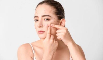 Pürüzsüz cilde kavuşmanızı sağlayan bakım rehberi: Sivilceden en hızlı kurtulmanın 7 yolu