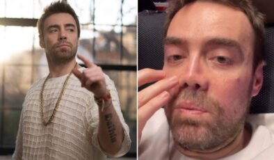 13 kez ameliyat olan Murat Dalkılıç: İki sene sonra burnum oldu