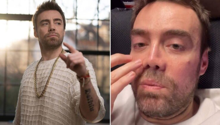 13 kez ameliyat olan Murat Dalkılıç: İki sene sonra burnum oldu