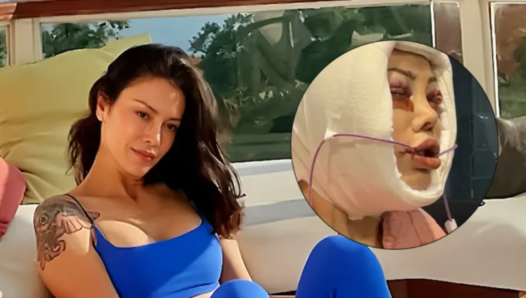 Didem Ceran'ın yüz nakli sonrası inanılmaz değişimi