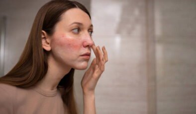 Asitli serumları kullanırken dikkat: Farkında olmadan cilde zarar veriyor…