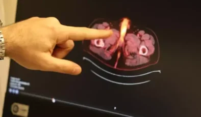 Tıp literatürüne giren son isim Diyarbakır'dan! Penisi alındı