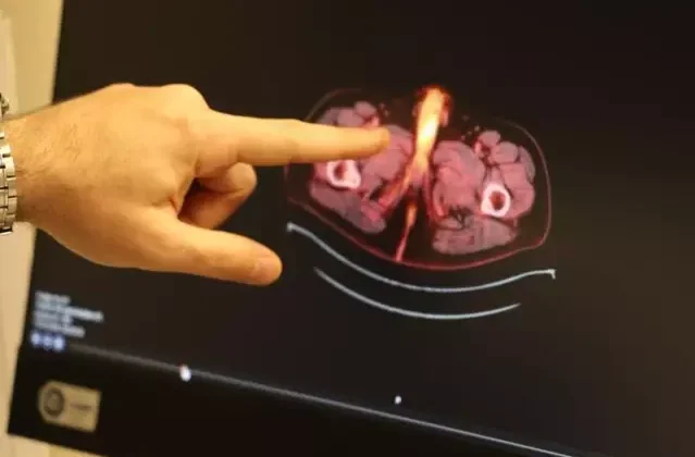 Tıp literatürüne giren son isim Diyarbakır'dan! Penisi alındı