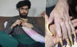 Türkiye'nin konuştuğu Barış'ın son hali! 25 yaşını kutladı, türkü bile söyledi