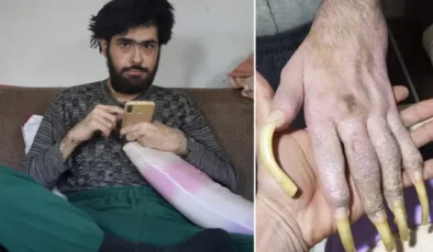 Türkiye'nin konuştuğu Barış'ın son hali! 25 yaşını kutladı, türkü bile söyledi