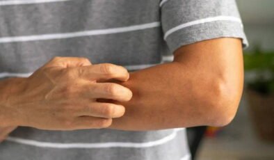 Vücuttaki o kaşıntıyı hafife almayın: Onkologlar uyardı, 4 farklı kanserin habercisi olabilir