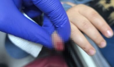 AVM'de yürüyen merdivene eli sıkışan çocuğun parmağı koptu