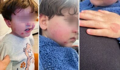 Kreşe bıraktığı çocuğunu darp edilmiş halde aldı