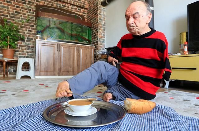 Doğduğu gün ölümüne karar verilen Mehmet Amca'nın hayat hikayesi ağlattı