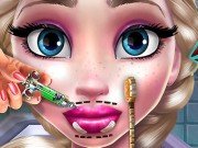 Elsa Dudak Ameliyatı