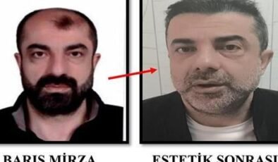 HABERLER: Ameliyat ile yüzünü değiştirmiş! 7 yıl sonra yakalandı…