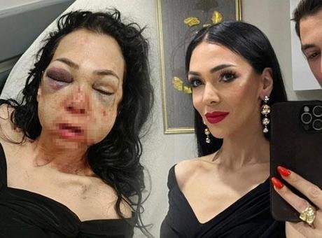 Hayatı bir günde değişti! Kocaeli’de dehşeti yaşayan kadın konuştu: Asla eskisi gibi olamayacağım