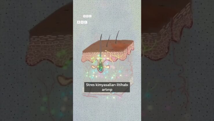Stres cildimizi nasıl etkiliyor?